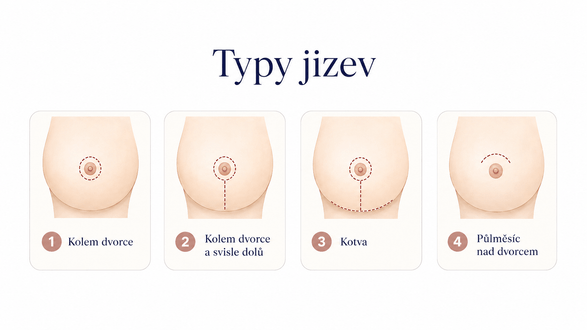 jizvy modealce