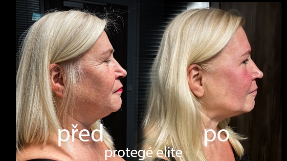 protege_elite_1