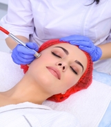 Diamond microdermabrasion